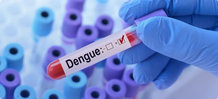 Dengue: Don't ignore these symptoms