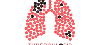 All you need to Know about Tuberculosis